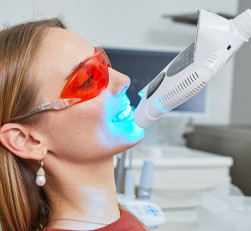 Отбеливание зубов Magic Smile (США)